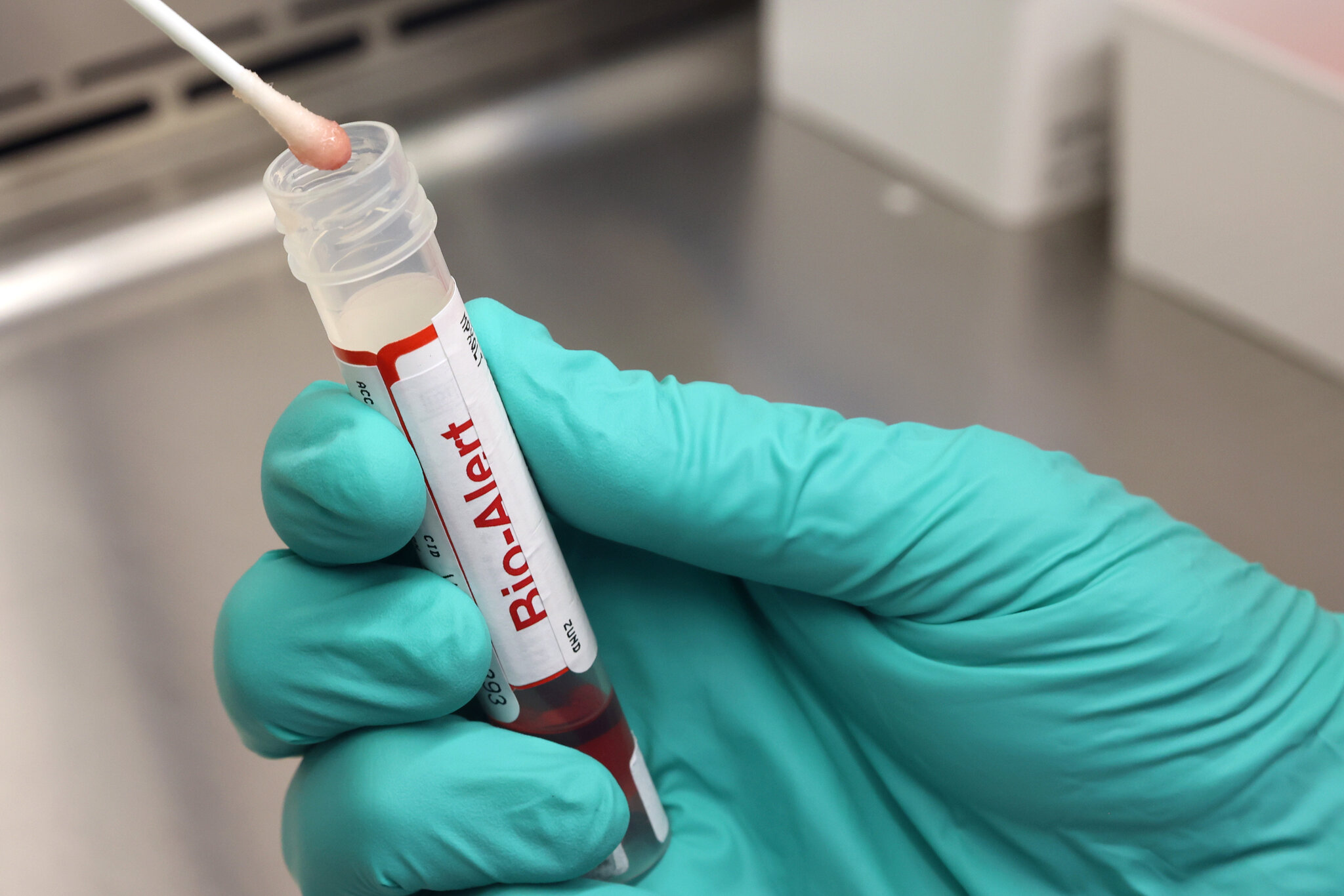 C.D.C. Pauses Testing for Rabies and Pox Viruses