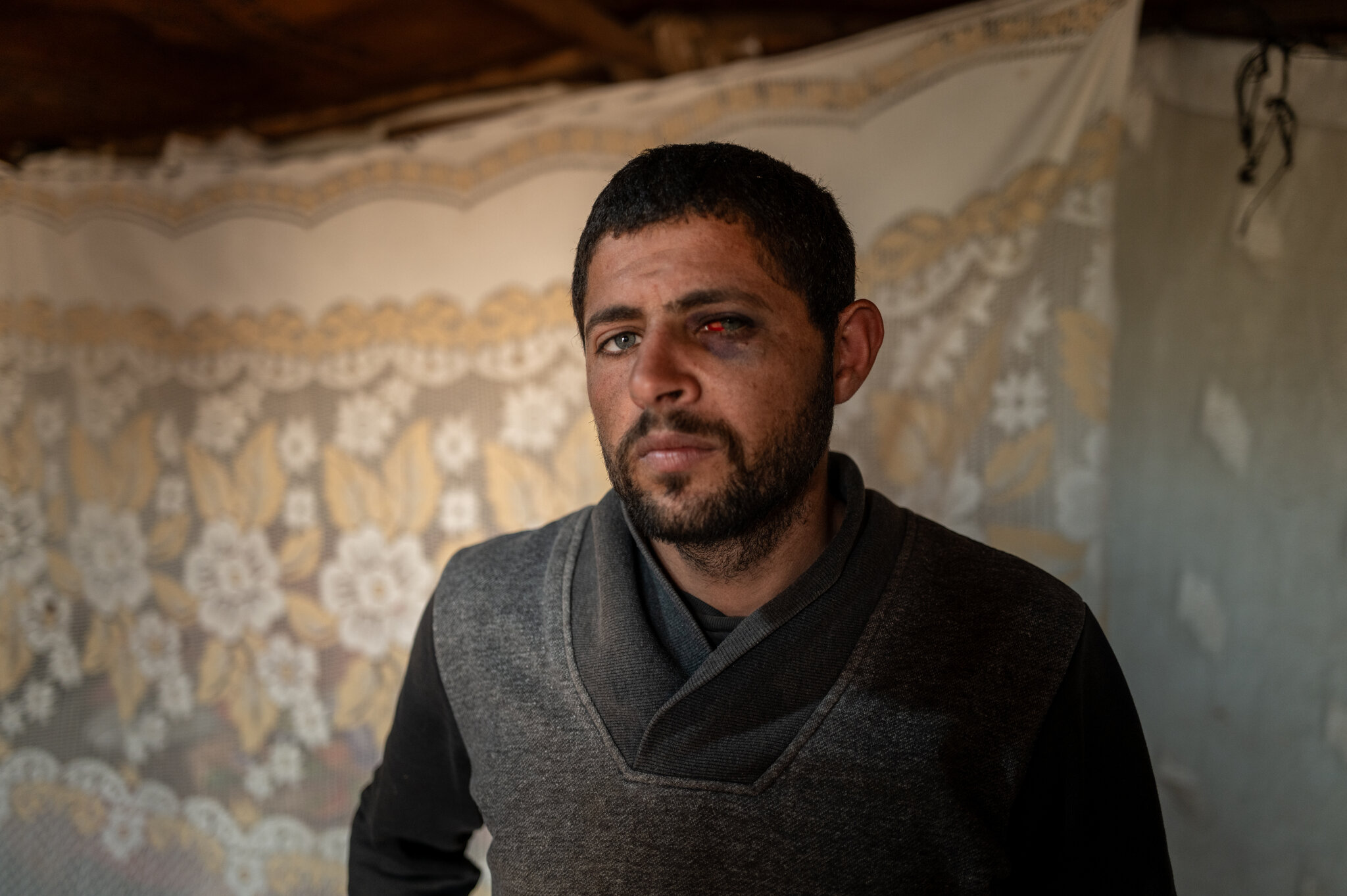 Palestinian Man Recounts Brutal Sexual Assault by Israeli Settlers