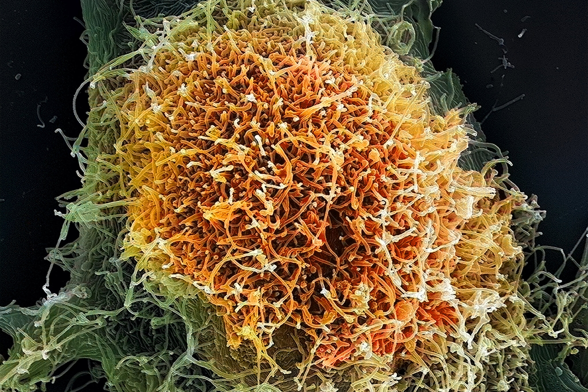 The Viruses Causing New Outbreaks Are Much Less Familiar to Science
