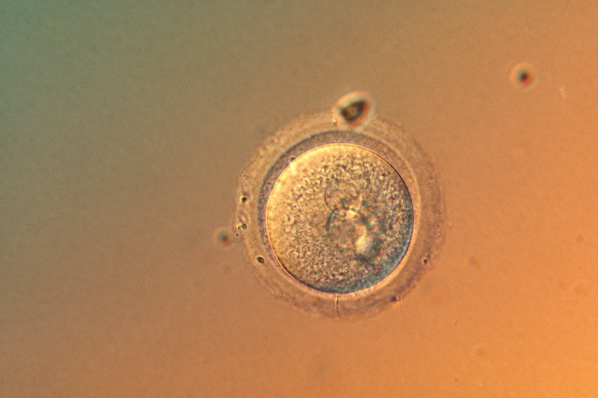 In a First, Scientists Precisely Edit Human Embryo Genes