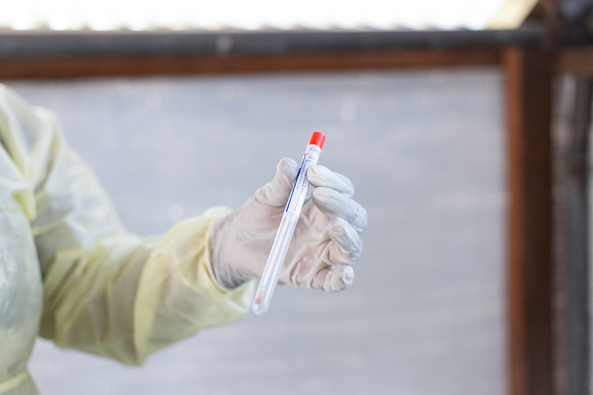 Dutch Scientist Charged With Conspiring to Smuggle Mpox Virus Into U.S.