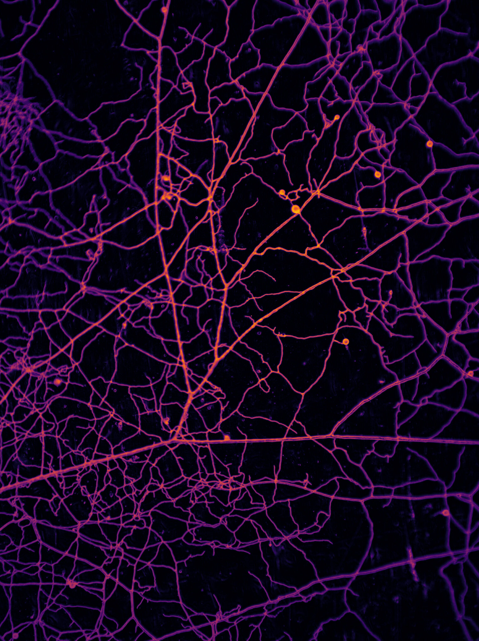 68 Quadrillion Underground Miles of Fungi