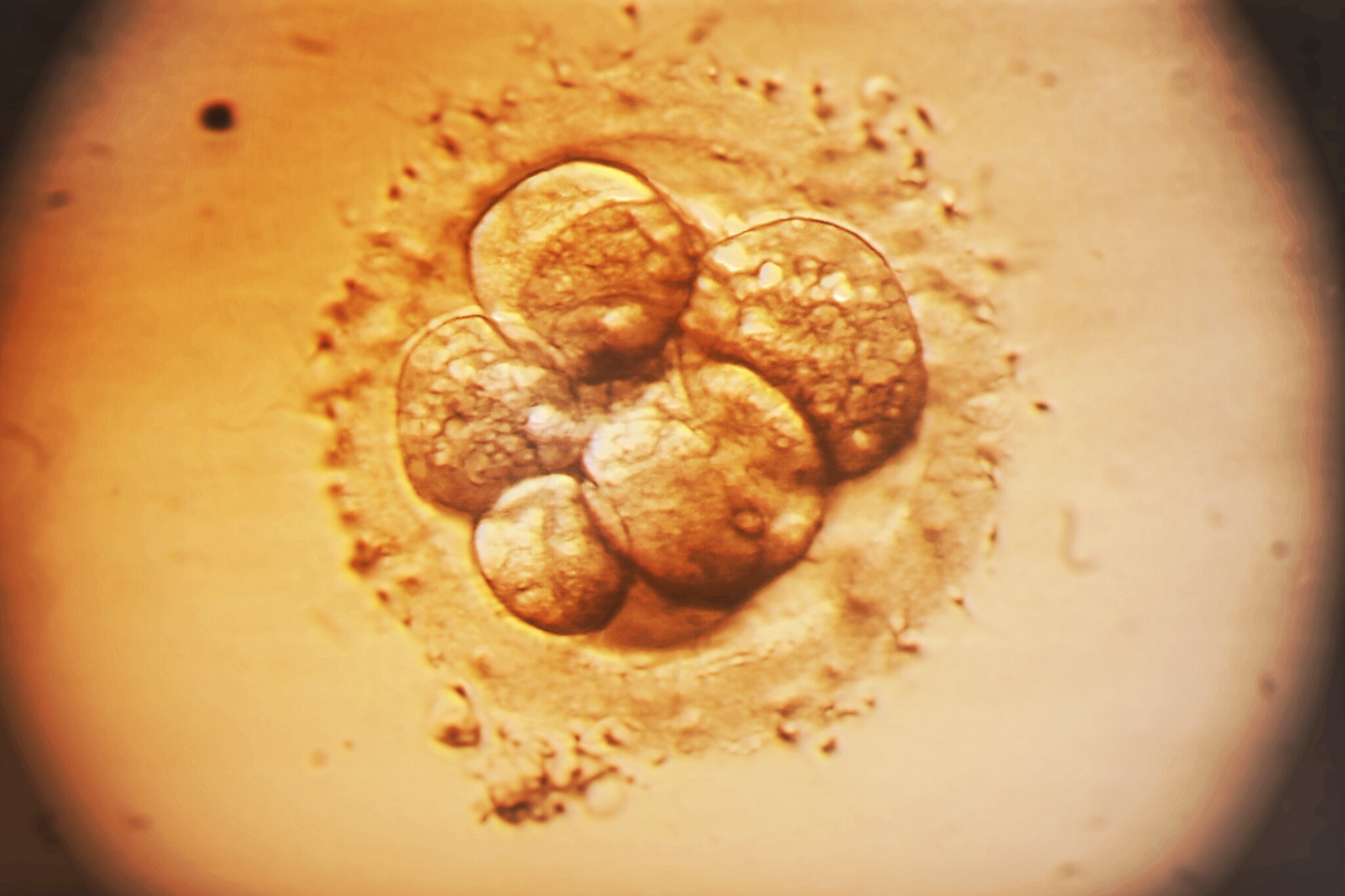 Medical Cure or Designer Baby? A New Approach to Editing Embryos Ignites Debate