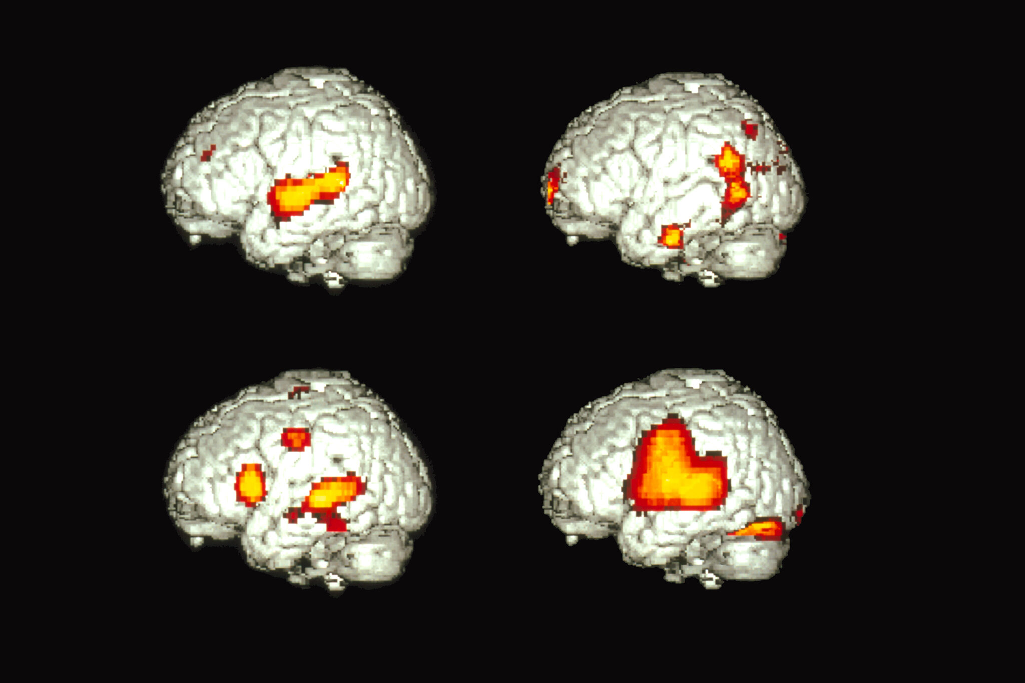 How Does One Brain Speak Two Languages?