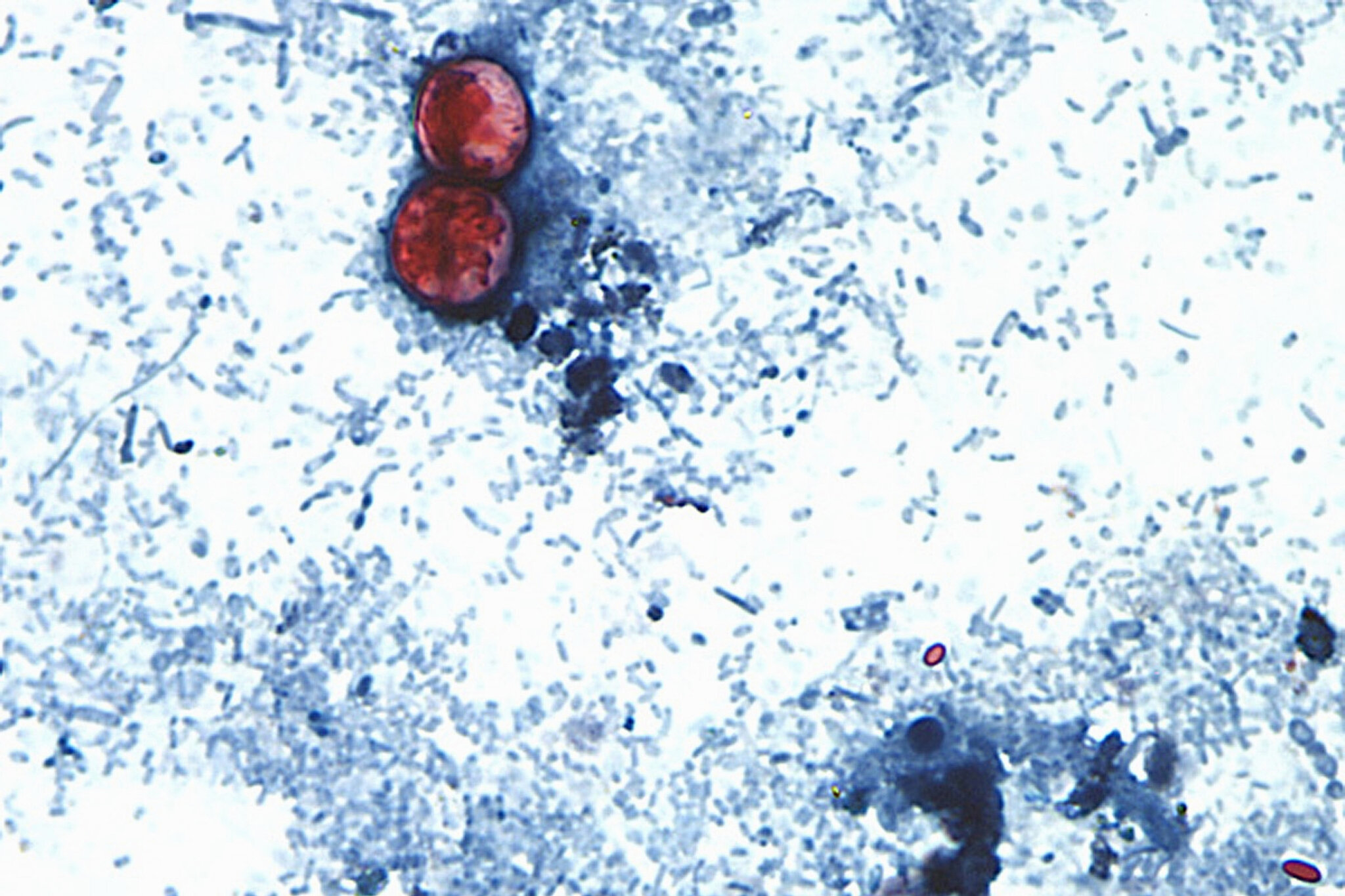 What the Cyclospora Outbreak Reveals