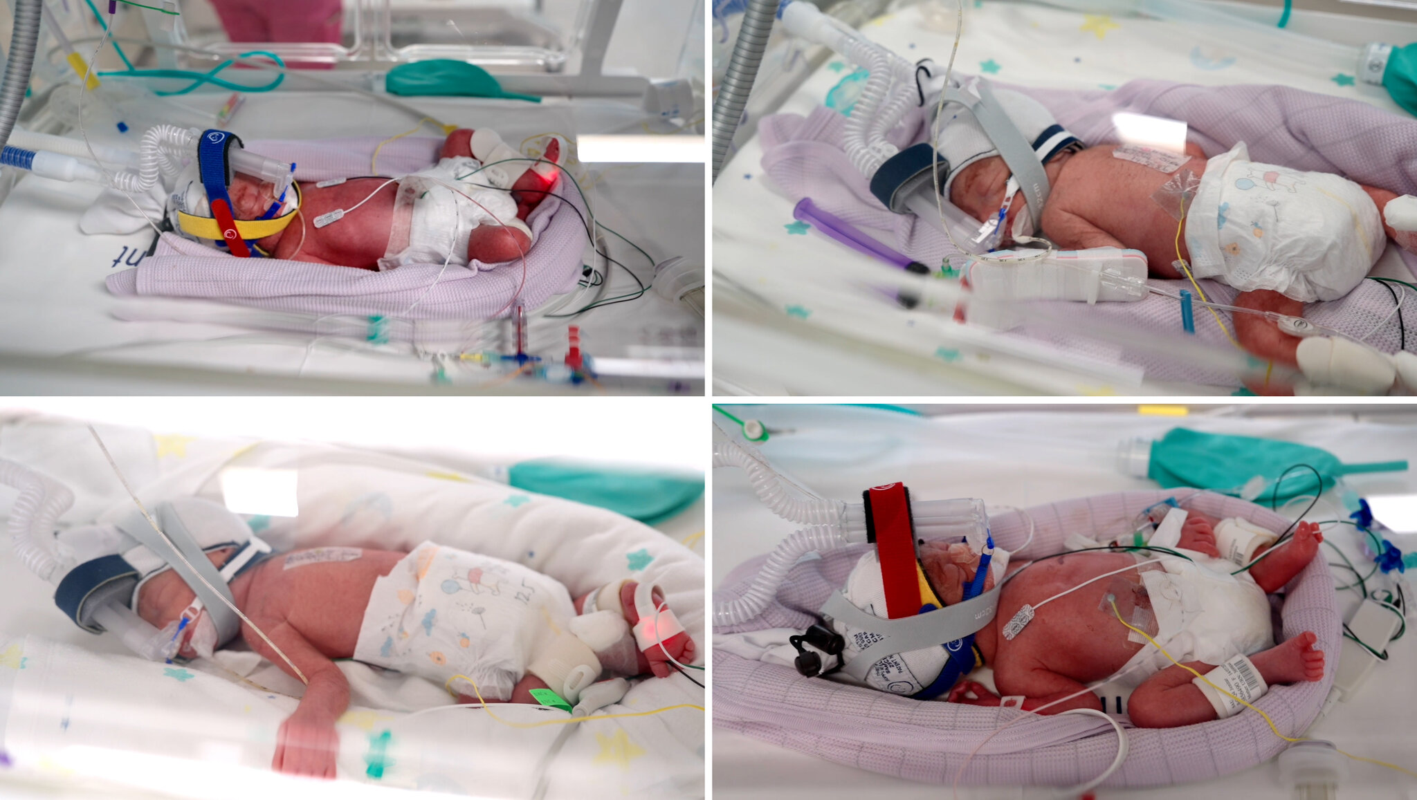 Australian Woman Gives Birth to ‘Miracle’ Identical Quadruplets
