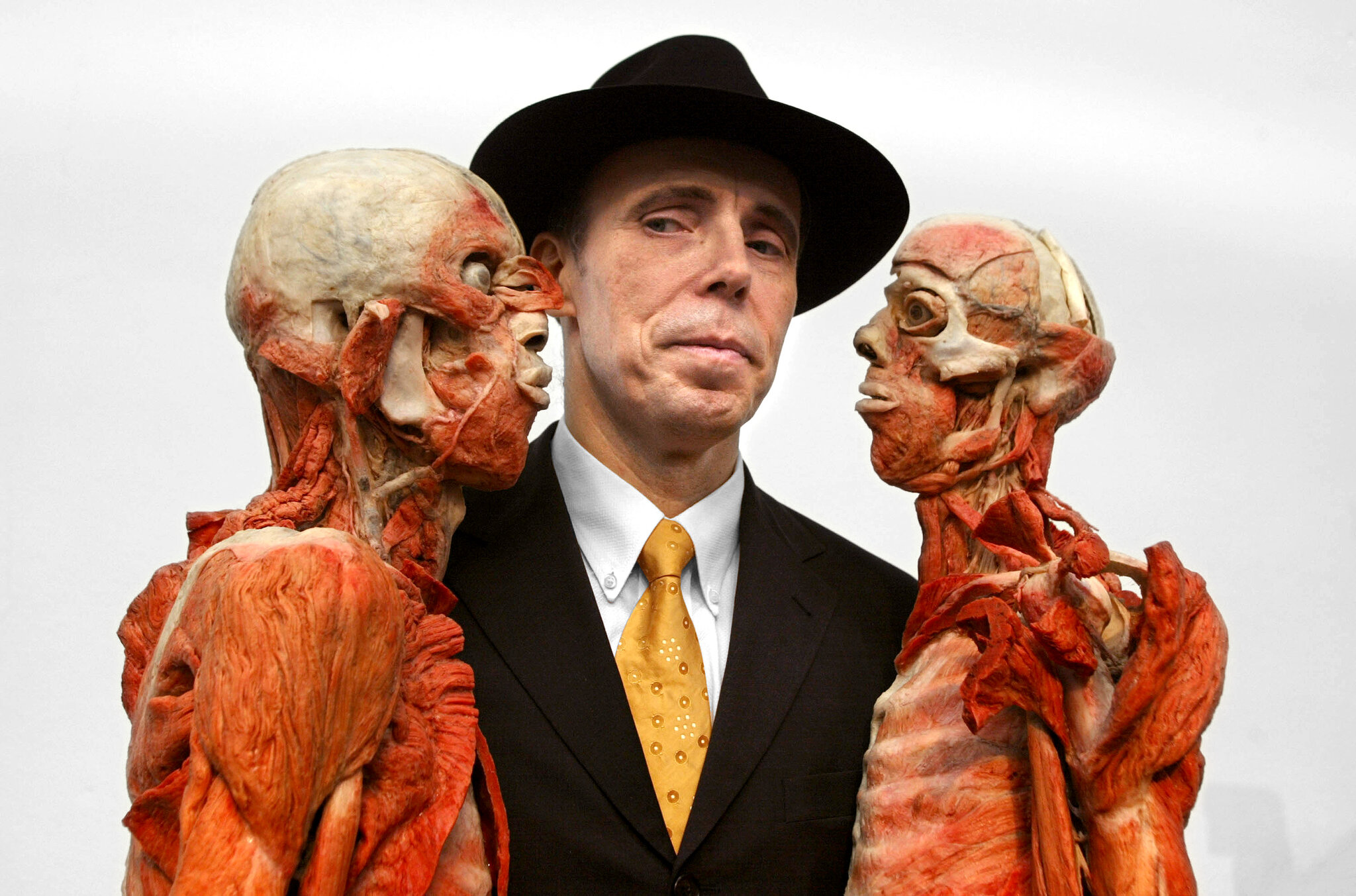 Gunther von Hagens, Creator of Polarizing ‘Body Worlds’ Exhibits, Dies at 81