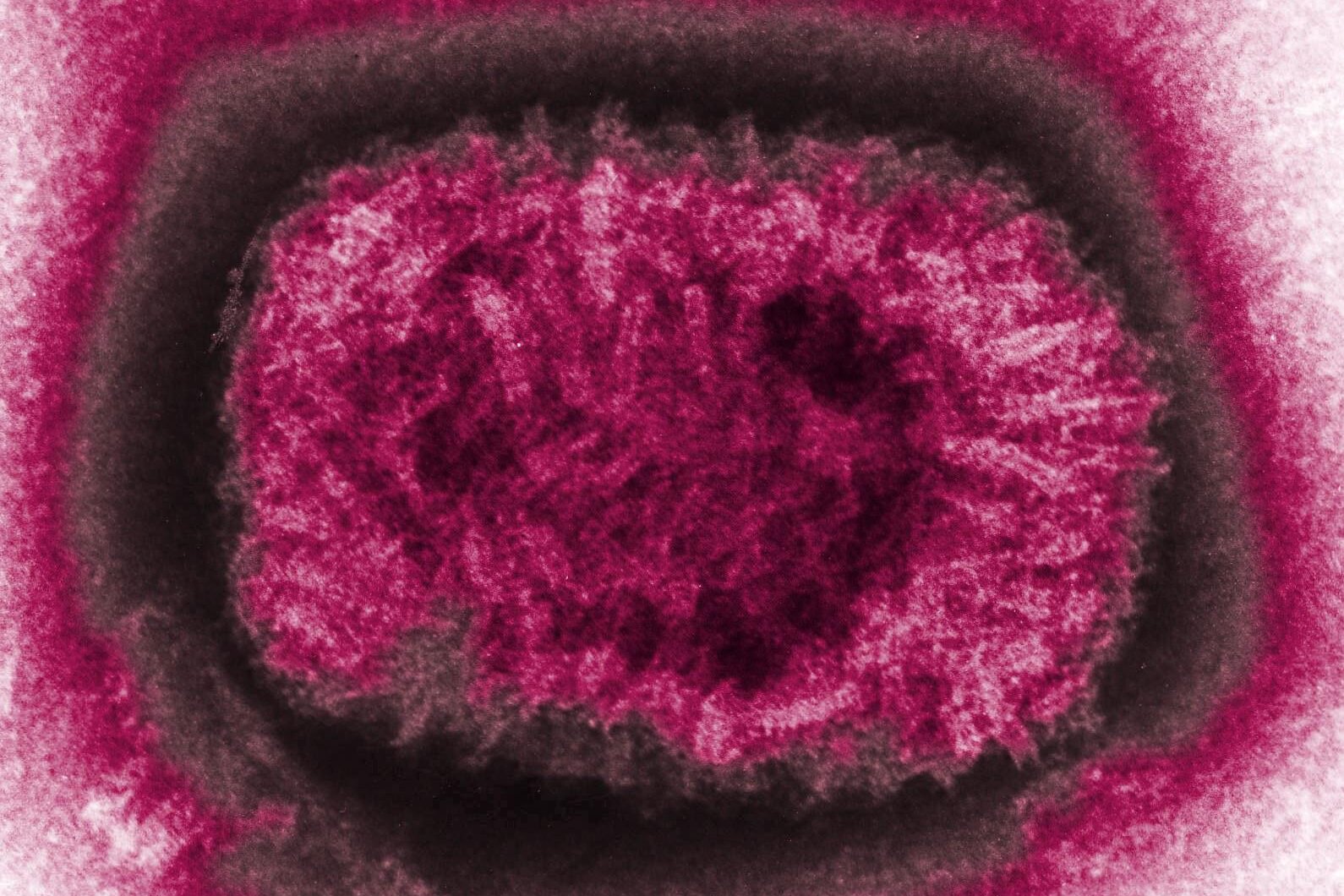 ‘This Is Very Strange’: Ancient Smallpox May Have Been Less Deadly